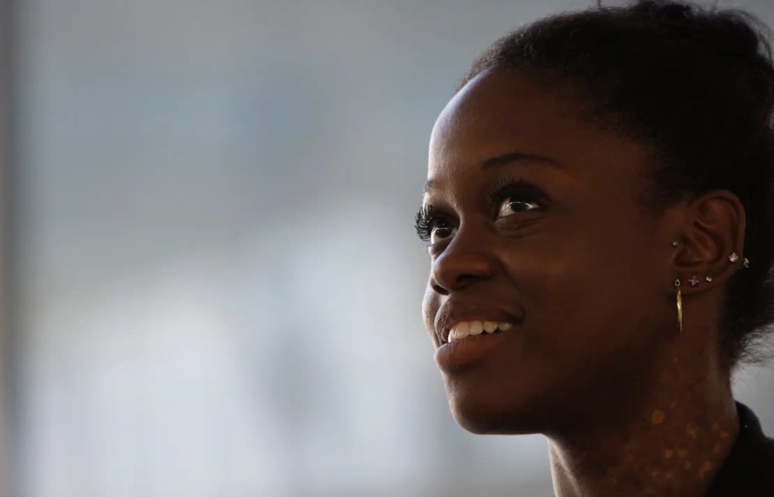 Michaela DePrince in Johannesburg, South Africa on July 9, 2012.